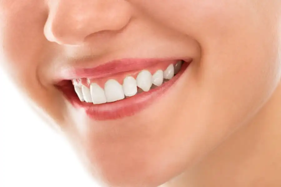 best teeth whitening abu dhabi 